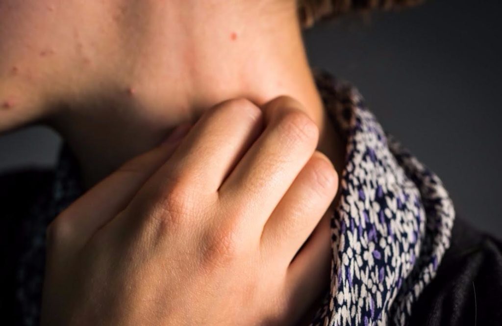 How to cure skin picking disorder